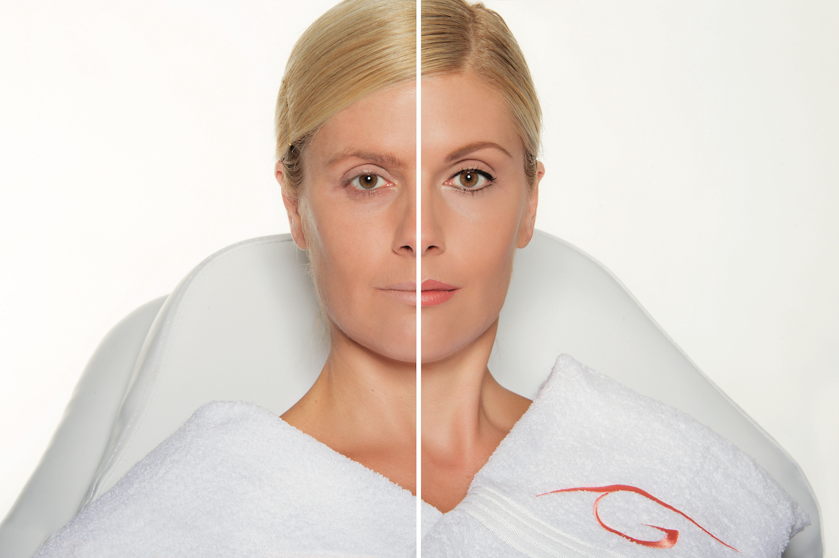 Eine Tätowierung hält ein Leben lang, Permanent Make-up dagegen ca. 1 bis 3 Jahre. | RPM Medical & Kosmetik Rafael-Peter Mischewski Mönchengladbach