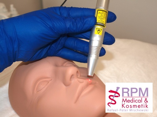 Soft Laser PMU-Behandlung | RPM Medical & Kosmetik Rafael-Peter Mischewski Mönchengladbach